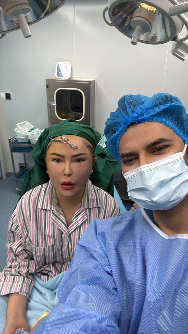 Hair Transplant Result