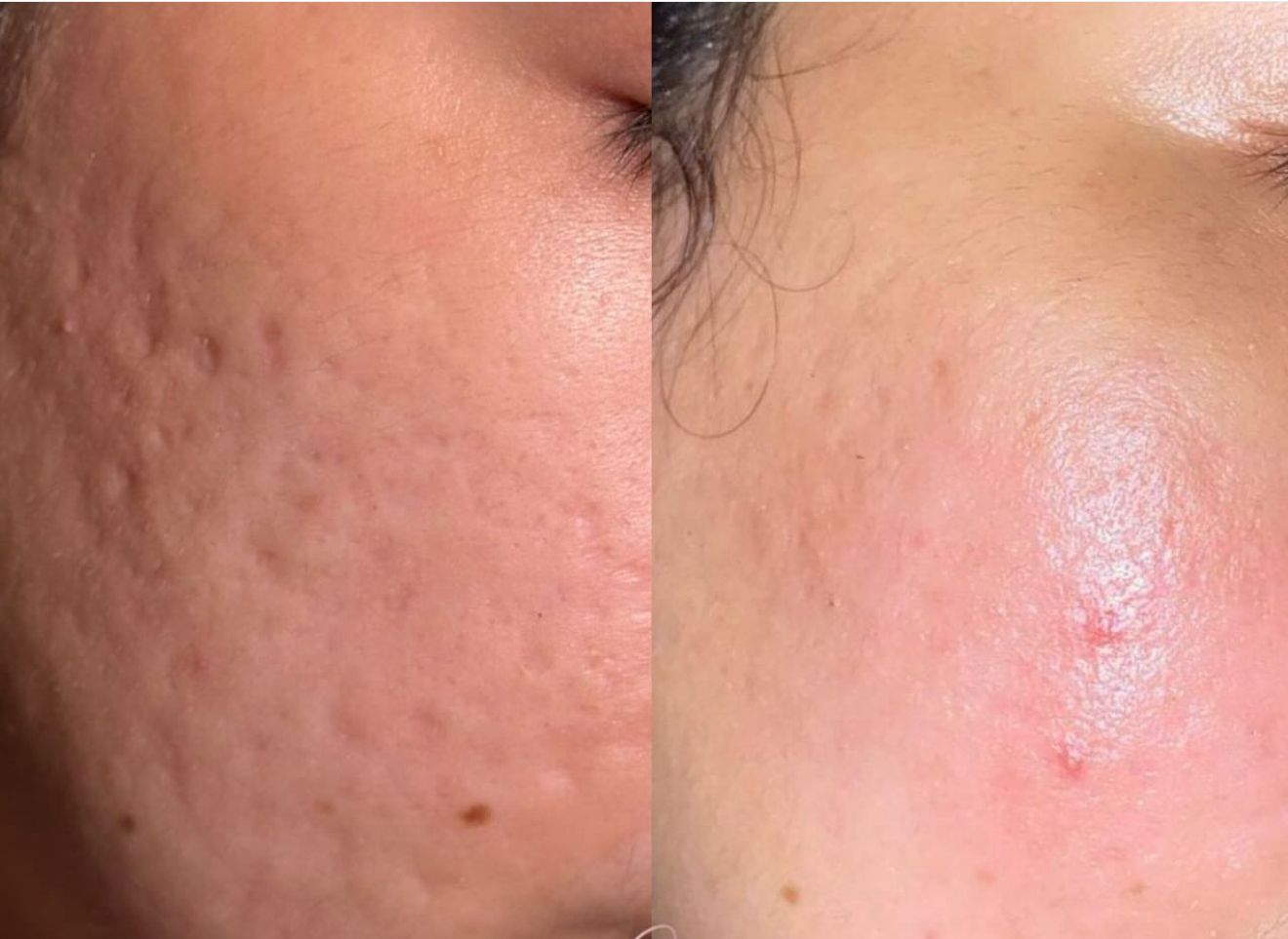 Executive Biohacking Residency