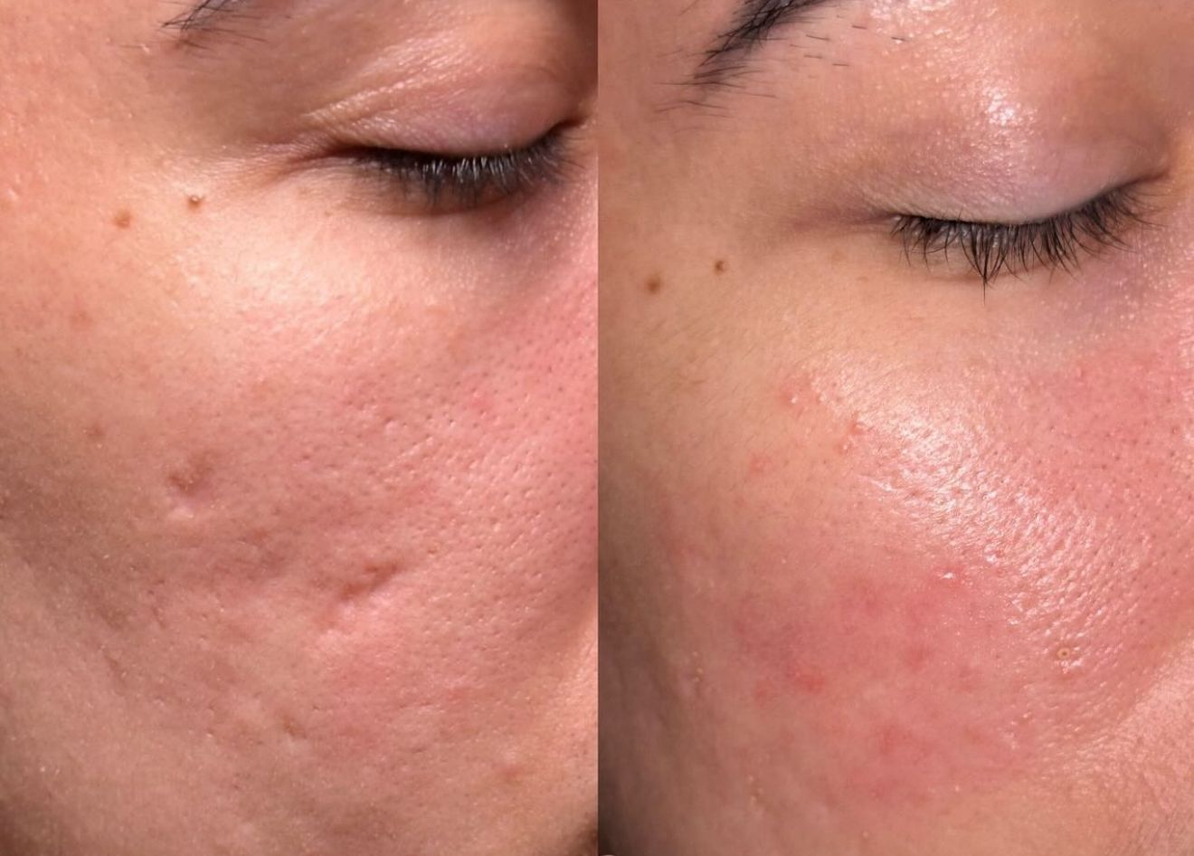 Hair Comeback Residency